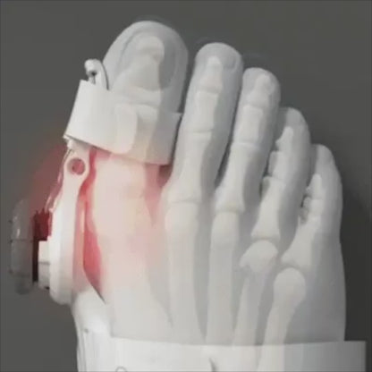 ComfoLign™ - Hallux valgus korrigerare